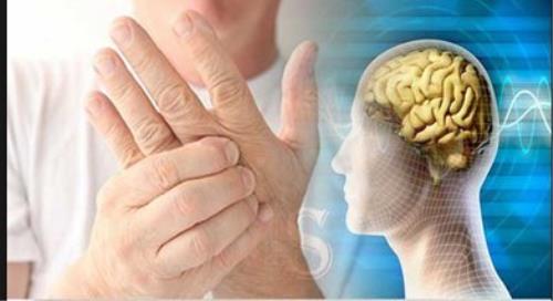 وجود 70 هزار مبتلا به ام اس در ایران