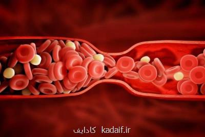 ارتباط رژیم غذایی چرب و بروز پلاك های چربی در عروق خونی