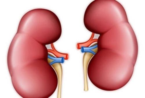 رژیم غذایی برای مساعدت با پیش گیری از تشکیل سنگ کلیه