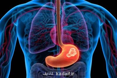 چند یادآوری مهم برای پیش گیری از سرطان معده