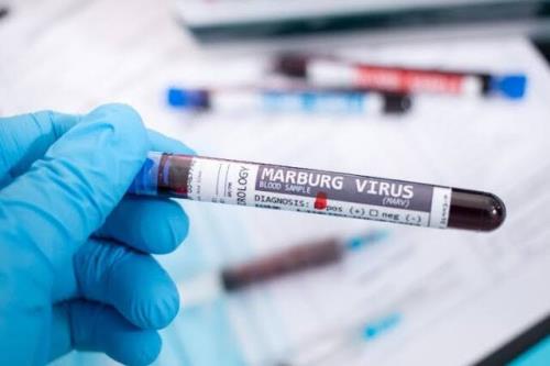 هشدار کشورهای عربی به مسافران درباره ی ویروس ماربورگ