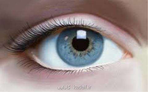 یك سفارش مفید برای سلامت چشم ها