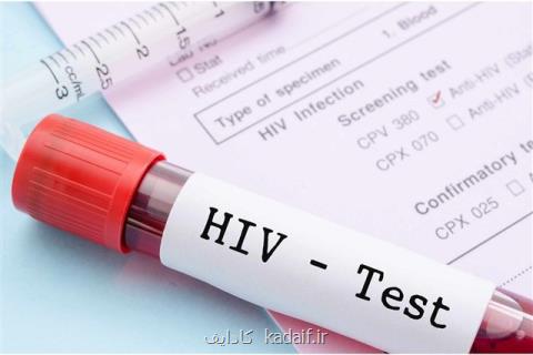 ریسك مبتلا شدن به ایدز در گروه های مختلف