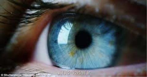 گردهمایی برنامه ملی ثبت بیماران ارثی شبكیه چشم برگزار می گردد