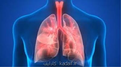 چه كسانی واكسن سینه پهلو تزریق كنند؟
