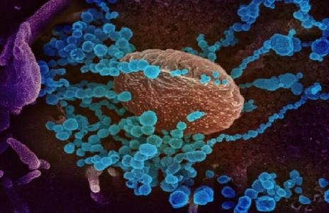 كاهش مرگ ومیر ناشی از كرونا ویروس با نانو فناوری