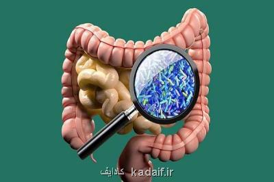 تأثیر رژیم غذایی پرچرب همراه با آنتی بیوتیك در بروز التهاب روده