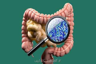 نقش میكروبیوم های روده در كووید ۱۹ و فواید پیشگیرانه پروبیوتیك ها